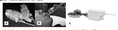 The Use of Remotely Controlled Mandibular Positioner as a 